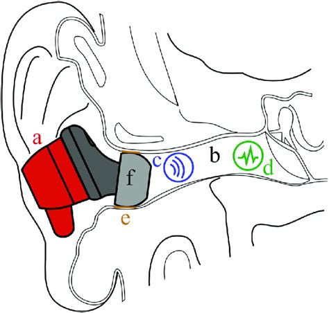 Earbud Fit Science Ear Canal Shapes & Tip Material Database